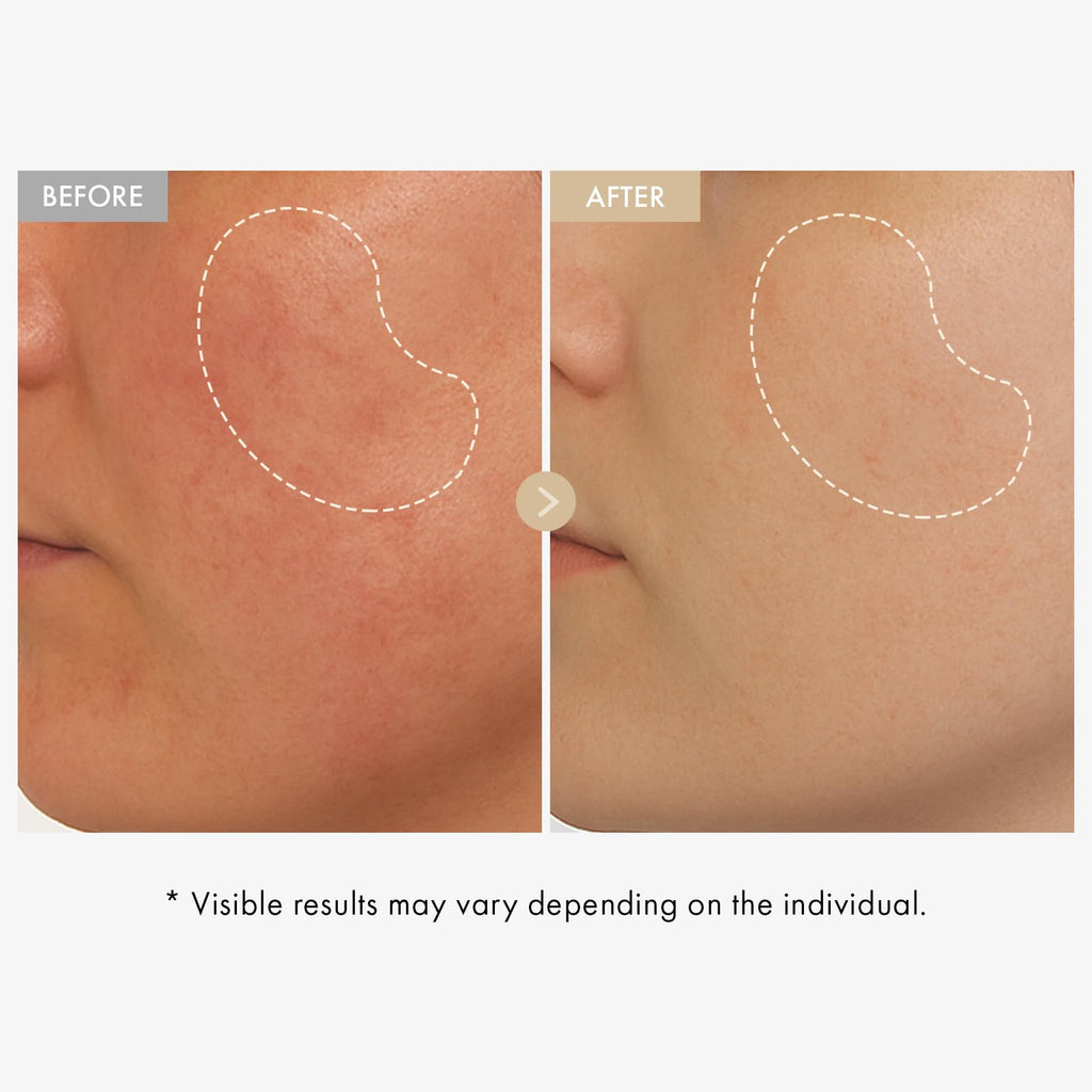 TOSOWOONG Honey Glow 65% Propolis Serum, Hyaluronic Acid, Kojic Acid, Niacinamide, Hydrating Facial Soothing Moisturizer for Irritated Uneven Skin Tone, Glass Skin, Korean Skin Care, 33ml, 1.11 fl.oz.