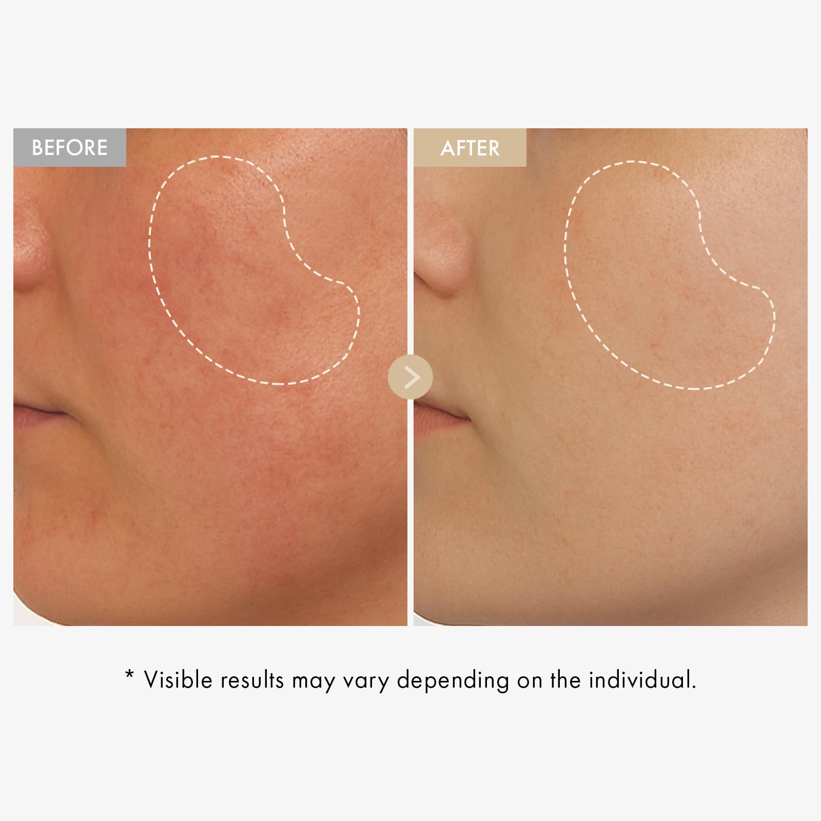 TOSOWOONG Honey Glow 65% Propolis Serum, Hyaluronic Acid, Kojic Acid, Niacinamide, Hydrating Facial Soothing Moisturizer for Irritated Uneven Skin Tone, Glass Skin, Korean Skin Care, 33ml, 1.11 fl.oz.