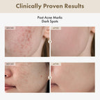 TOSOWOONG Honey Glow 65% Propolis Serum, Hyaluronic Acid, Kojic Acid, Niacinamide, Hydrating Facial Soothing Moisturizer for Irritated Uneven Skin Tone, Glass Skin, Korean Skin Care, 33ml, 1.11 fl.oz.