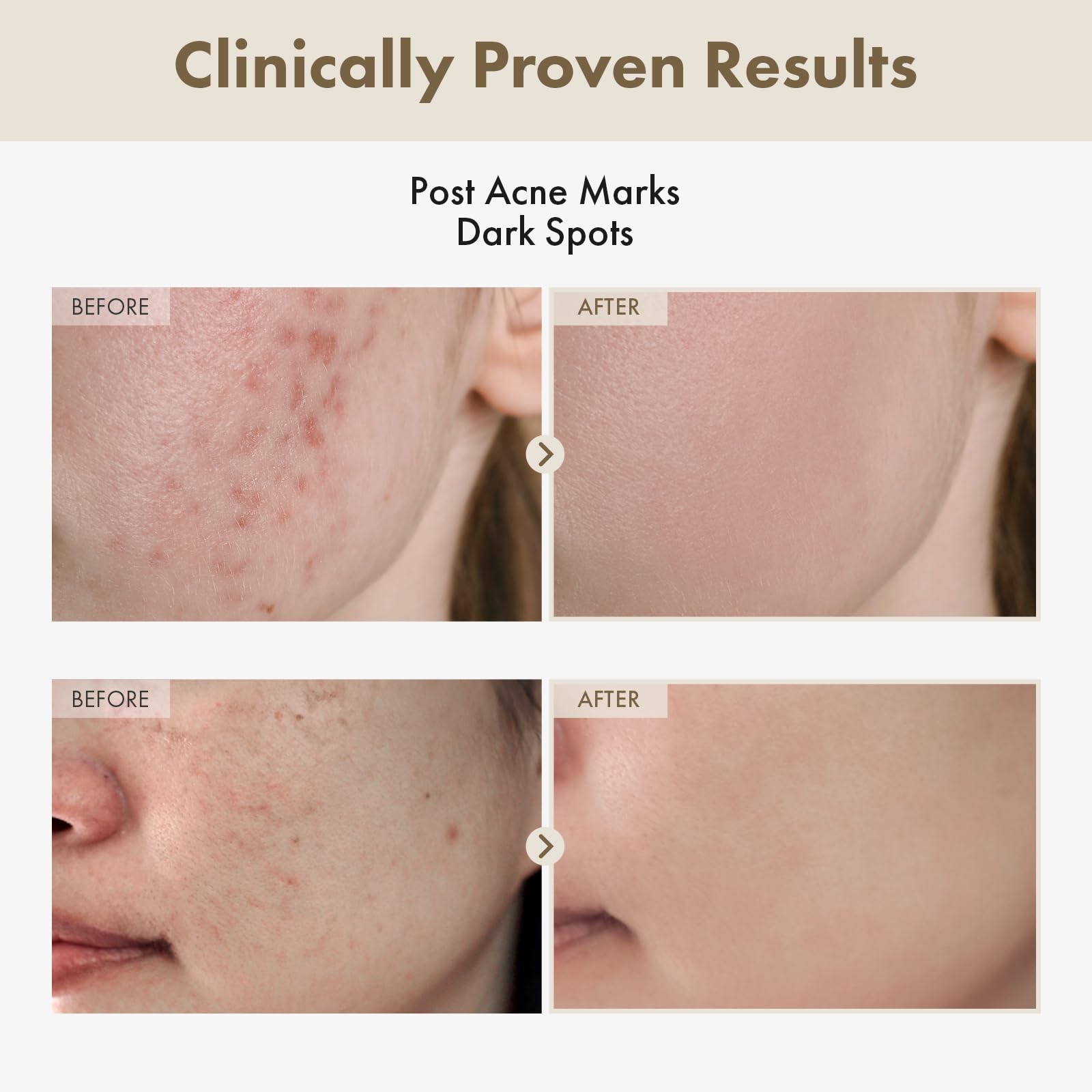 TOSOWOONG Honey Glow 65% Propolis Serum, Hyaluronic Acid, Kojic Acid, Niacinamide, Hydrating Facial Soothing Moisturizer for Irritated Uneven Skin Tone, Glass Skin, Korean Skin Care, 33ml, 1.11 fl.oz.