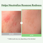 TOSOWOONG Honey Glow 65% Propolis Serum, Hyaluronic Acid, Kojic Acid, Niacinamide, Hydrating Facial Soothing Moisturizer for Irritated Uneven Skin Tone, Glass Skin, Korean Skin Care, 33ml, 1.11 fl.oz.