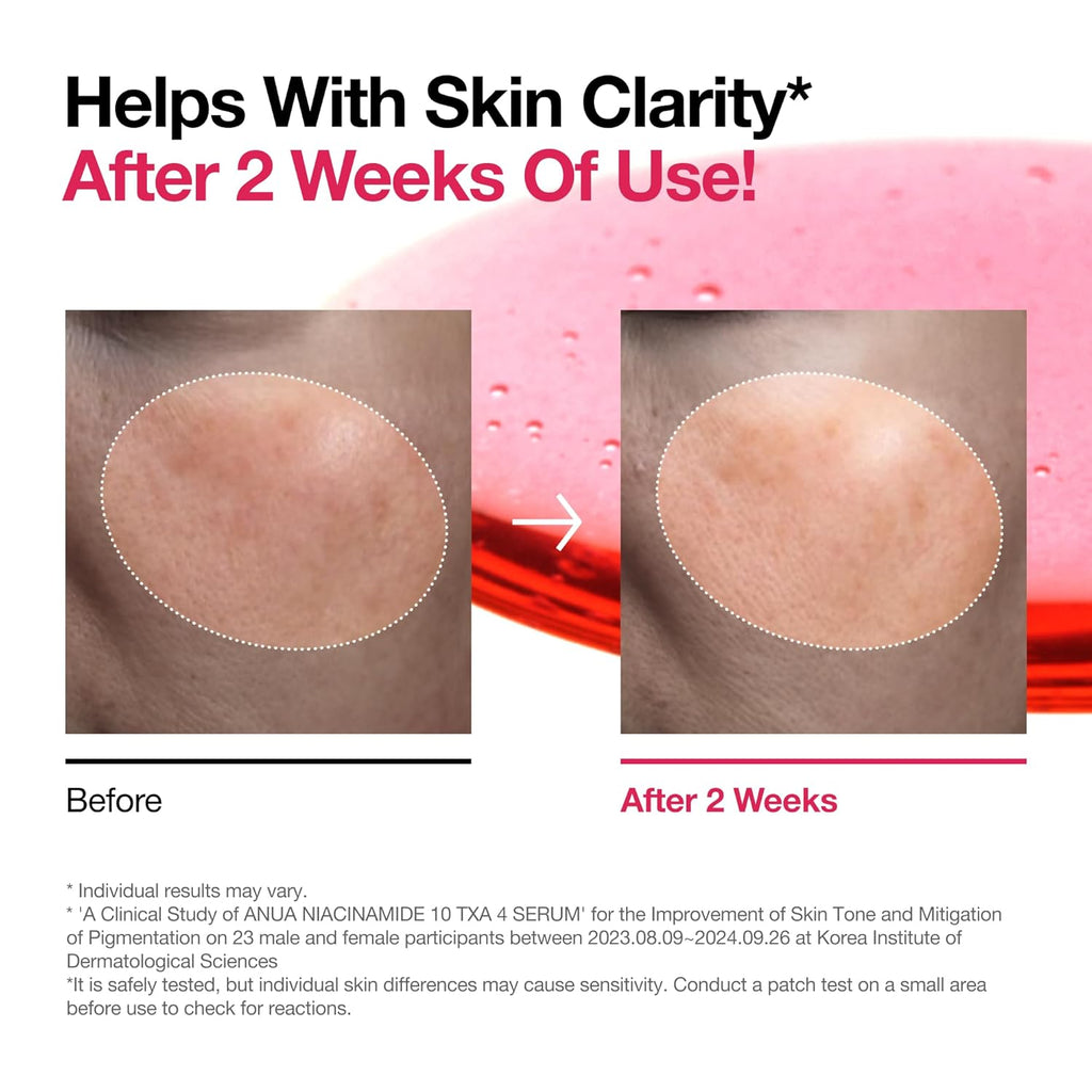 ANUA Niacinamide 10 + TXA 4 Serum, Hyaluronic Acid, Tranexamic acid, Facial Serum For GlassSkin, Glow Back Serum, Dark Spot Care, Postnatal Skincare, Korean Skincare (30ml/1.01 fl.oz)