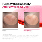 ANUA Niacinamide 10 + TXA 4 Serum, Hyaluronic Acid, Tranexamic acid, Facial Serum For GlassSkin, Glow Back Serum, Dark Spot Care, Postnatal Skincare, Korean Skincare (30ml/1.01 fl.oz)