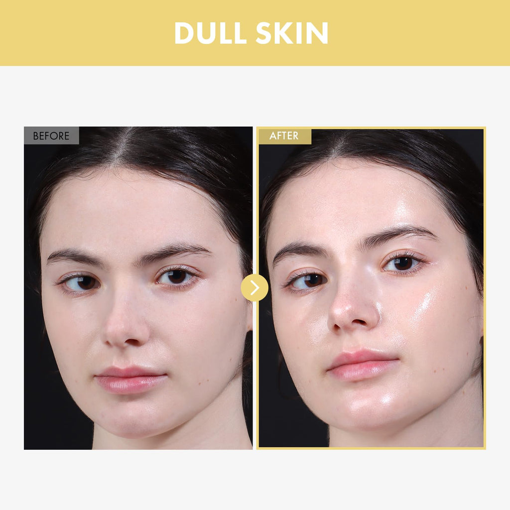 TOSOWOONG Honey Glow 65% Propolis Serum, Hyaluronic Acid, Kojic Acid, Niacinamide, Hydrating Facial Soothing Moisturizer for Irritated Uneven Skin Tone, Glass Skin, Korean Skin Care, 33ml, 1.11 fl.oz.