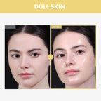 TOSOWOONG Honey Glow 65% Propolis Serum, Hyaluronic Acid, Kojic Acid, Niacinamide, Hydrating Facial Soothing Moisturizer for Irritated Uneven Skin Tone, Glass Skin, Korean Skin Care, 33ml, 1.11 fl.oz.