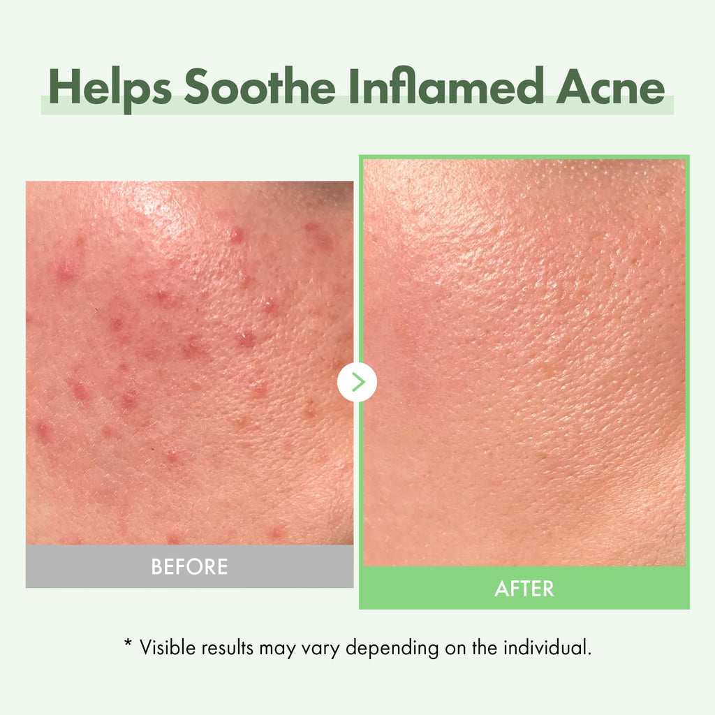 TOSOWOONG Honey Glow 65% Propolis Serum, Hyaluronic Acid, Kojic Acid, Niacinamide, Hydrating Facial Soothing Moisturizer for Irritated Uneven Skin Tone, Glass Skin, Korean Skin Care, 33ml, 1.11 fl.oz.