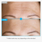 TOSOWOONG Honey Glow 65% Propolis Serum, Hyaluronic Acid, Kojic Acid, Niacinamide, Hydrating Facial Soothing Moisturizer for Irritated Uneven Skin Tone, Glass Skin, Korean Skin Care, 33ml, 1.11 fl.oz.