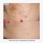 TOSOWOONG Honey Glow 65% Propolis Serum, Hyaluronic Acid, Kojic Acid, Niacinamide, Hydrating Facial Soothing Moisturizer for Irritated Uneven Skin Tone, Glass Skin, Korean Skin Care, 33ml, 1.11 fl.oz.