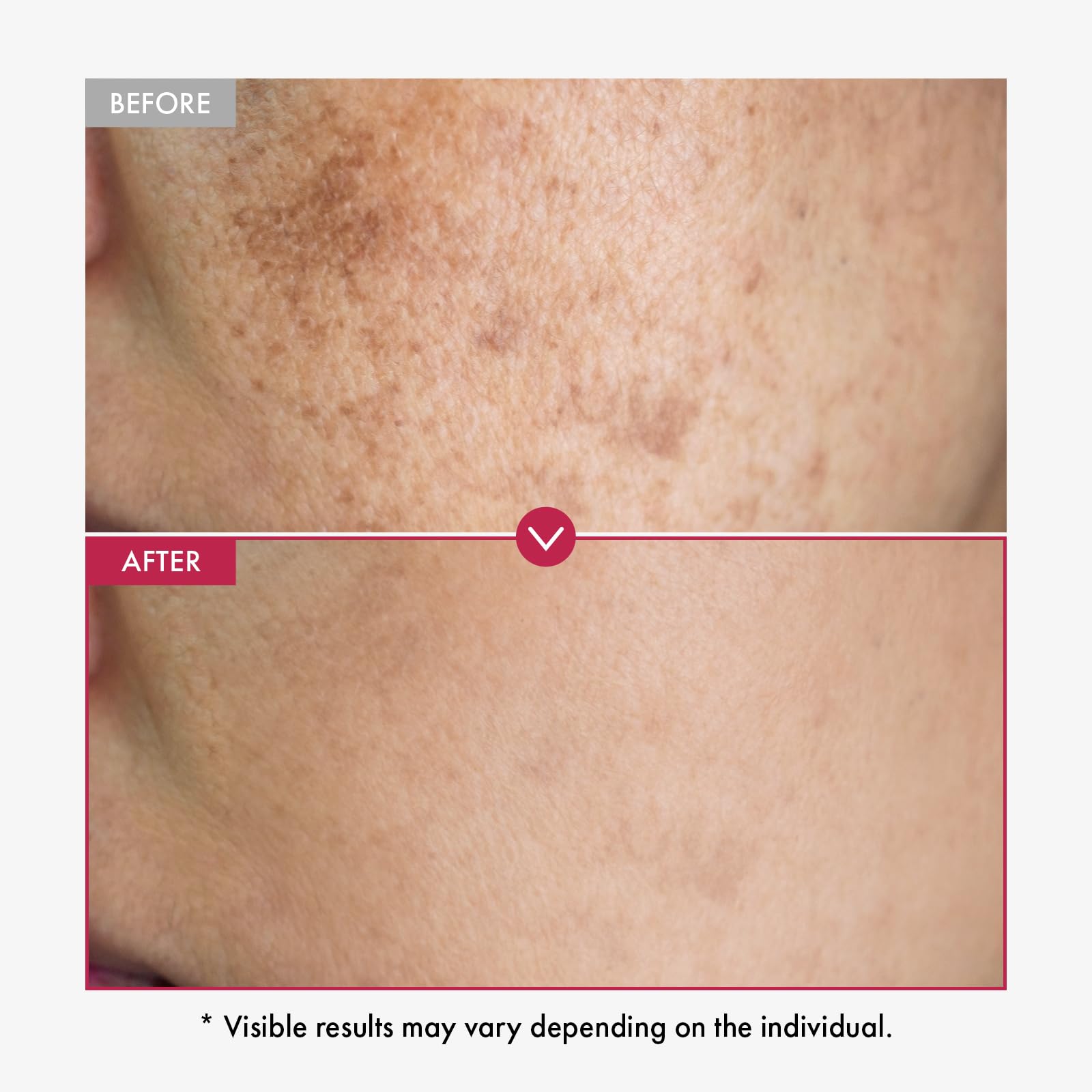 TOSOWOONG Honey Glow 65% Propolis Serum, Hyaluronic Acid, Kojic Acid, Niacinamide, Hydrating Facial Soothing Moisturizer for Irritated Uneven Skin Tone, Glass Skin, Korean Skin Care, 33ml, 1.11 fl.oz.