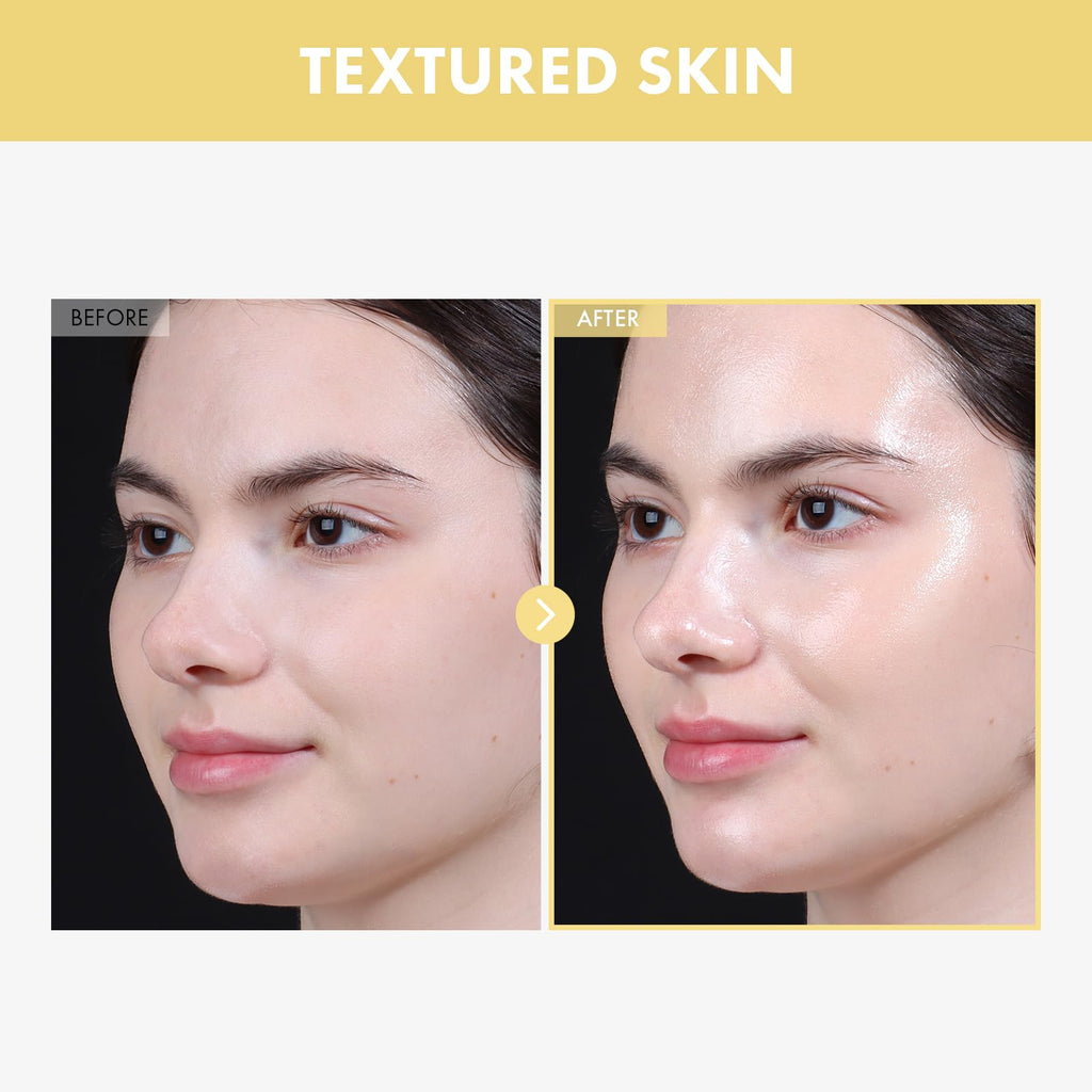 TOSOWOONG Honey Glow 65% Propolis Serum, Hyaluronic Acid, Kojic Acid, Niacinamide, Hydrating Facial Soothing Moisturizer for Irritated Uneven Skin Tone, Glass Skin, Korean Skin Care, 33ml, 1.11 fl.oz.