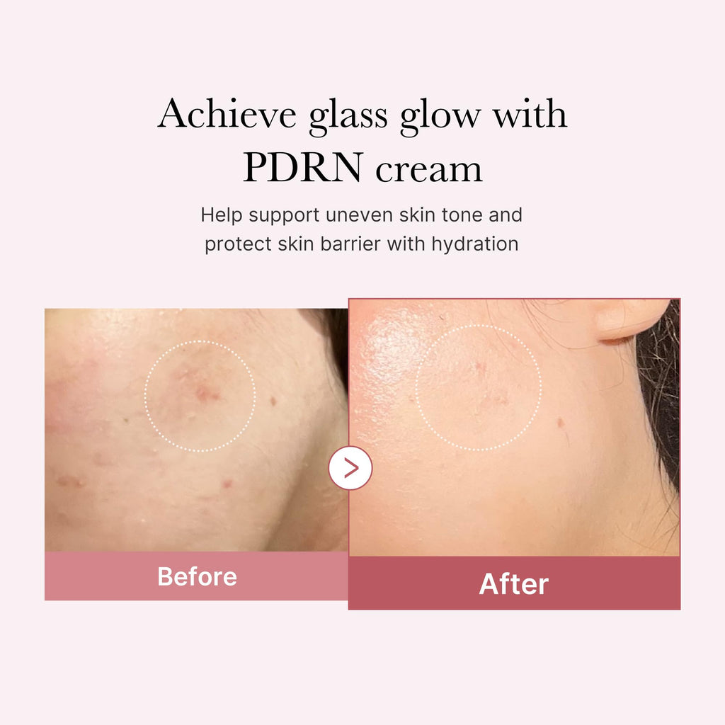 medicube PDRN Pink Hyaluronic Moisturizing Cream | Blemish Recovery, Relief & Hydrating Care | Restores Skin Elasticity & Glow | Korean Skincare for Even Skin Tone & Pore Care | 50ml / 1.69 fl.oz.