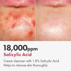 TOSOWOONG Salicylic Acid Foam Cleanser for Oily Skin, 18,000ppm Salicylic Acid, Deep Pore Cleansing, Face Wash For Breakouts, Exfoliating Cleanser, Korean Skin Care, 100ml, 3.38 fl. oz.