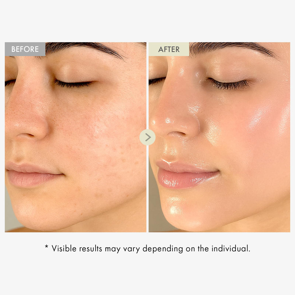 TOSOWOONG Honey Glow 65% Propolis Serum, Hyaluronic Acid, Kojic Acid, Niacinamide, Hydrating Facial Soothing Moisturizer for Irritated Uneven Skin Tone, Glass Skin, Korean Skin Care, 33ml, 1.11 fl.oz.