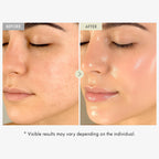 TOSOWOONG Honey Glow 65% Propolis Serum, Hyaluronic Acid, Kojic Acid, Niacinamide, Hydrating Facial Soothing Moisturizer for Irritated Uneven Skin Tone, Glass Skin, Korean Skin Care, 33ml, 1.11 fl.oz.