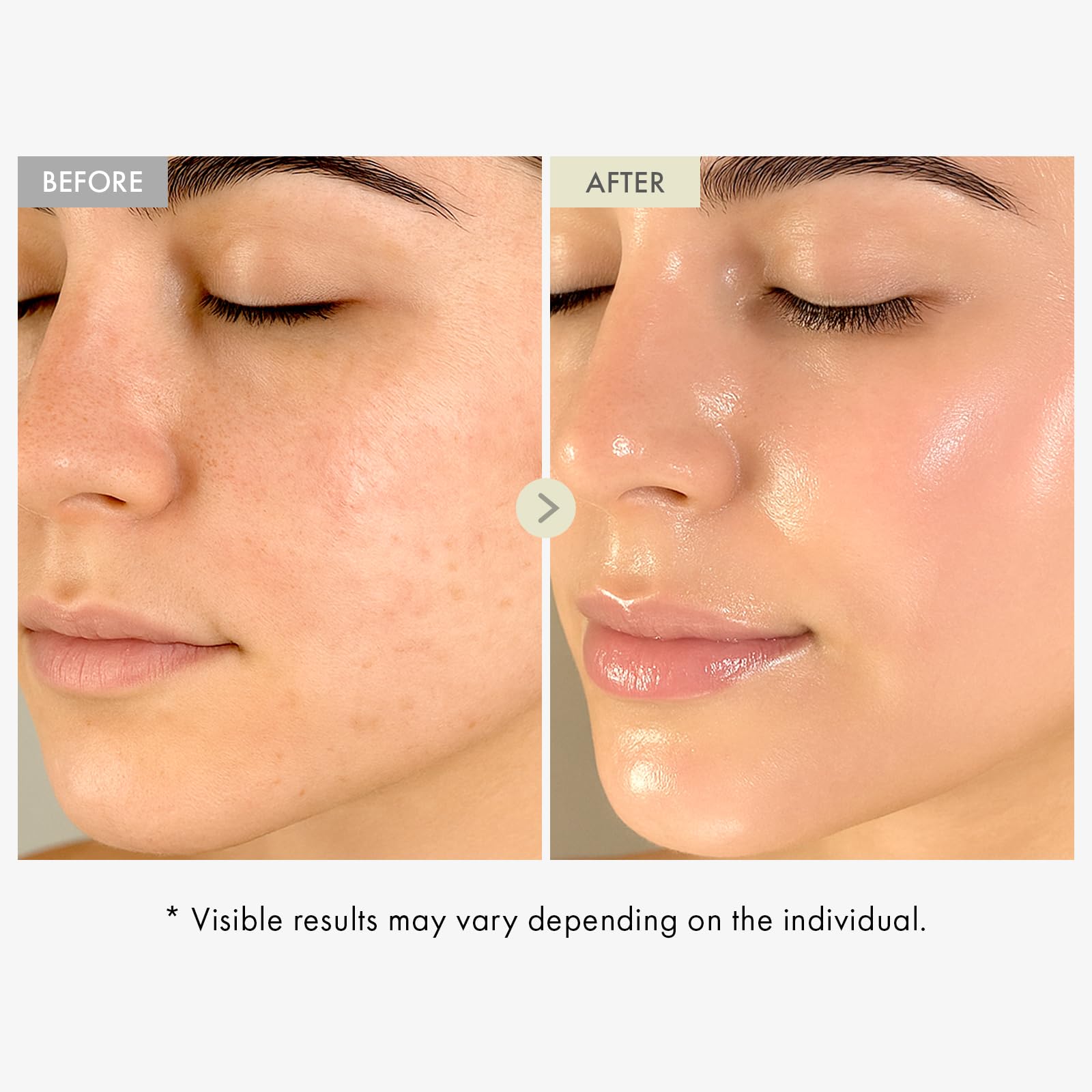 TOSOWOONG Honey Glow 65% Propolis Serum, Hyaluronic Acid, Kojic Acid, Niacinamide, Hydrating Facial Soothing Moisturizer for Irritated Uneven Skin Tone, Glass Skin, Korean Skin Care, 33ml, 1.11 fl.oz.