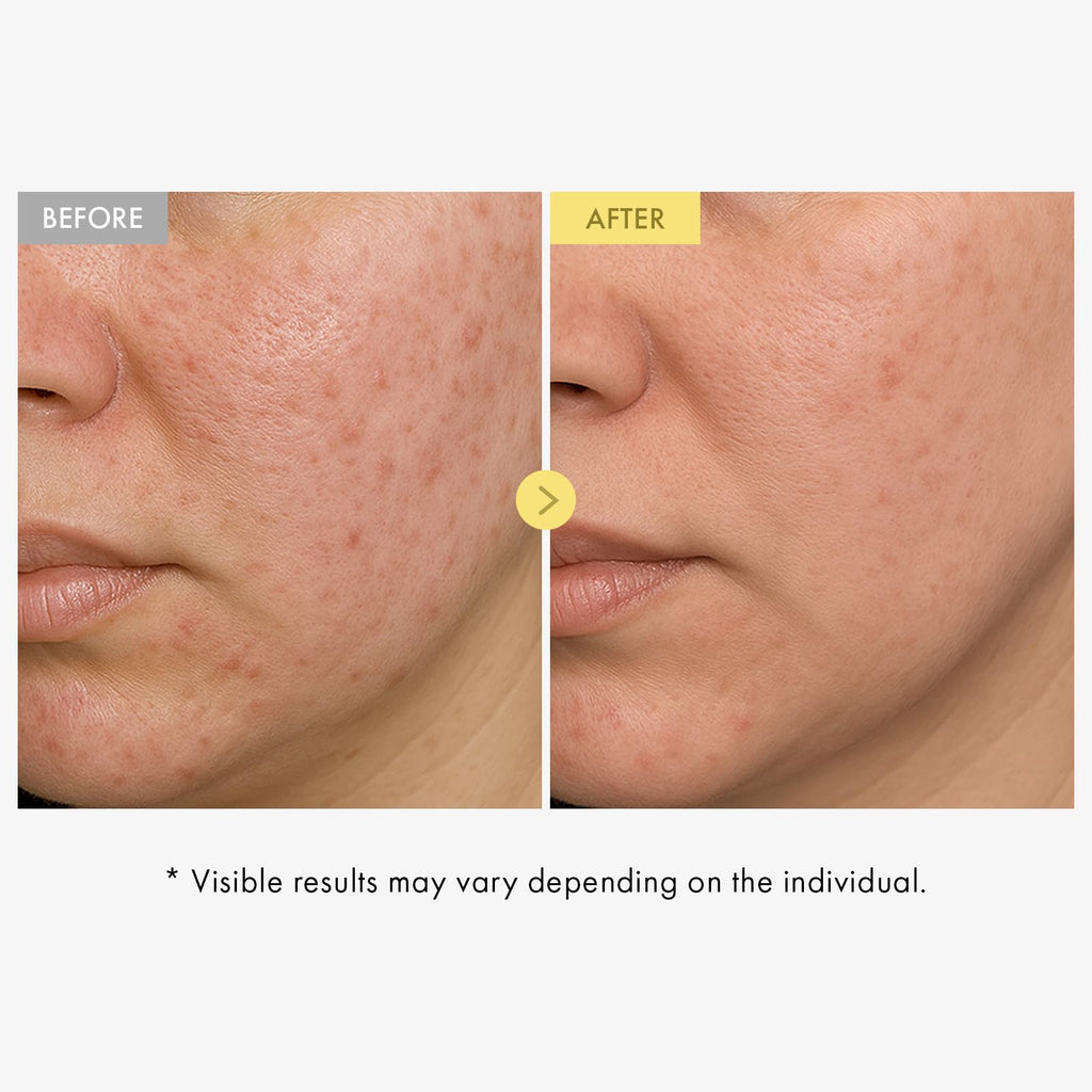 TOSOWOONG Honey Glow 65% Propolis Serum, Hyaluronic Acid, Kojic Acid, Niacinamide, Hydrating Facial Soothing Moisturizer for Irritated Uneven Skin Tone, Glass Skin, Korean Skin Care, 33ml, 1.11 fl.oz.