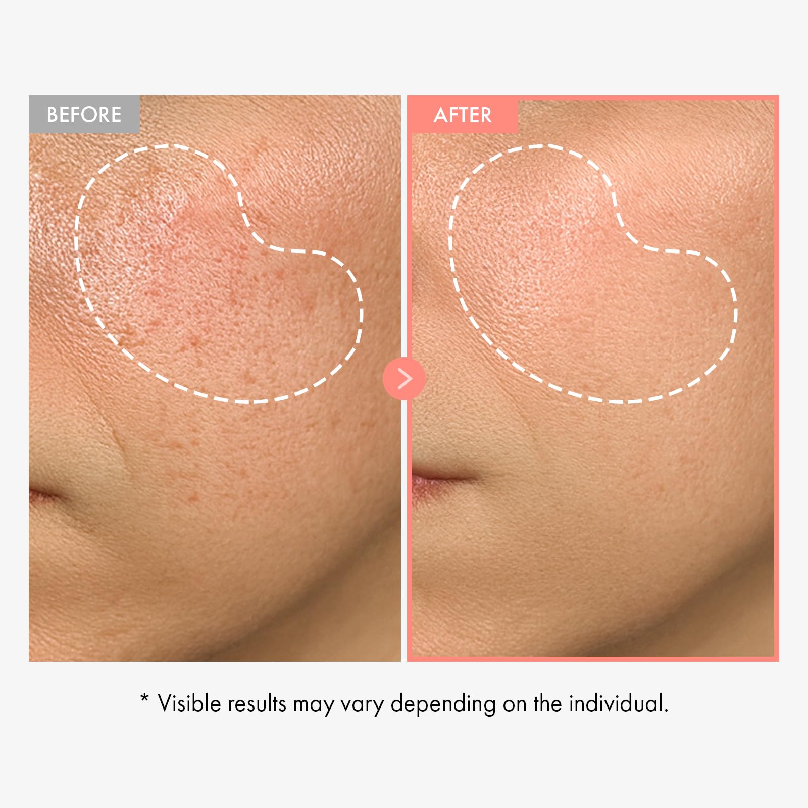 TOSOWOONG Honey Glow 65% Propolis Serum, Hyaluronic Acid, Kojic Acid, Niacinamide, Hydrating Facial Soothing Moisturizer for Irritated Uneven Skin Tone, Glass Skin, Korean Skin Care, 33ml, 1.11 fl.oz.