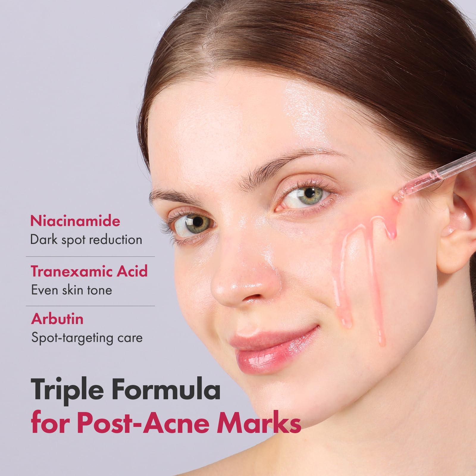 TOSOWOONG Honey Glow 65% Propolis Serum, Hyaluronic Acid, Kojic Acid, Niacinamide, Hydrating Facial Soothing Moisturizer for Irritated Uneven Skin Tone, Glass Skin, Korean Skin Care, 33ml, 1.11 fl.oz.